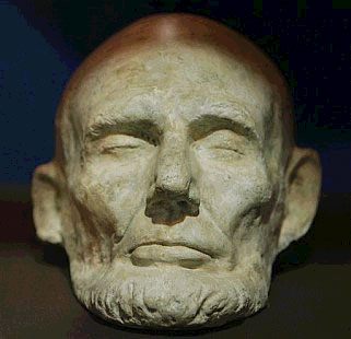 A life mask of President Lincoln shows a large degree of asymmetry in his face. 